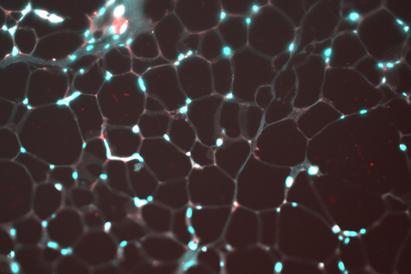 focus 3 - cachexia (formatted).jpg