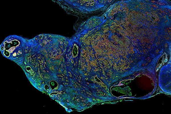 cellular plasticity
