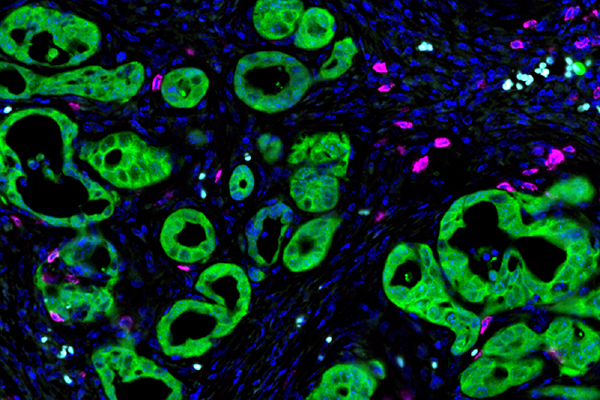 focus 2 - immune onc (formatted).jpg