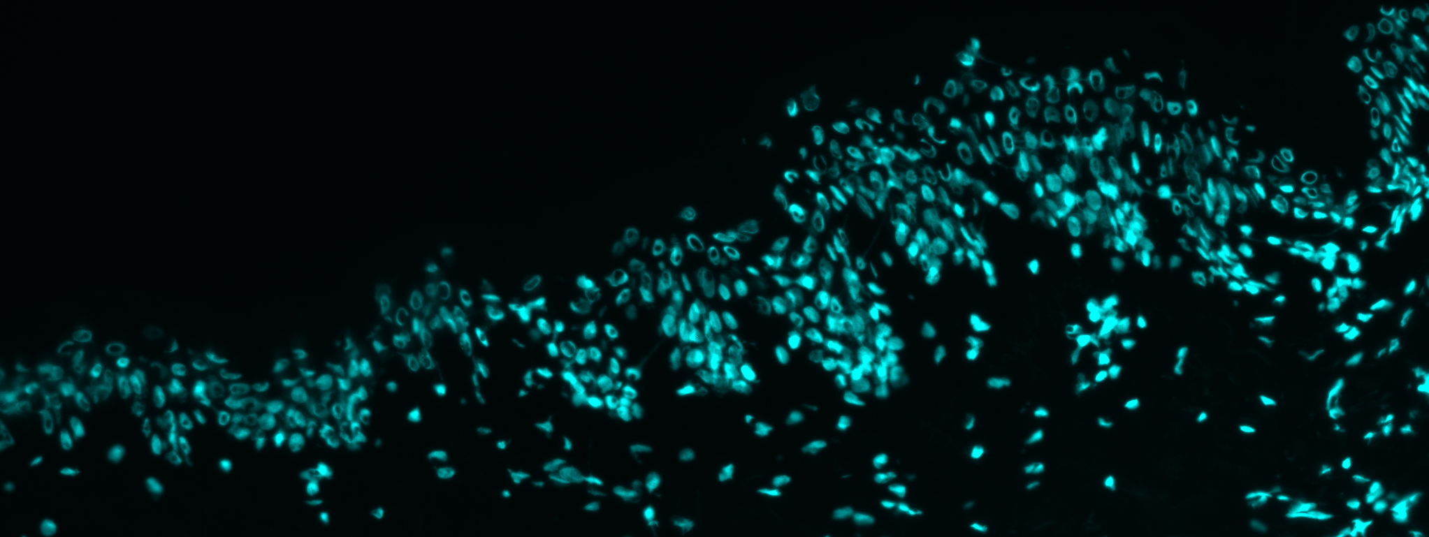 RNAi in the Skin