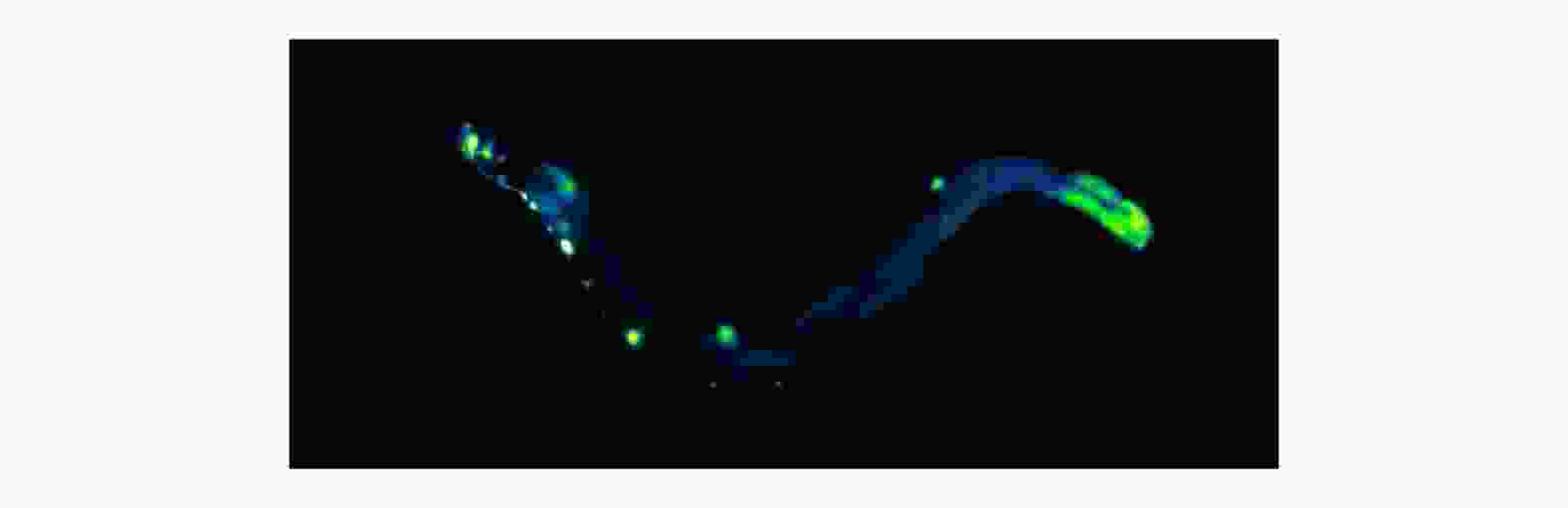 flp-18::GFP