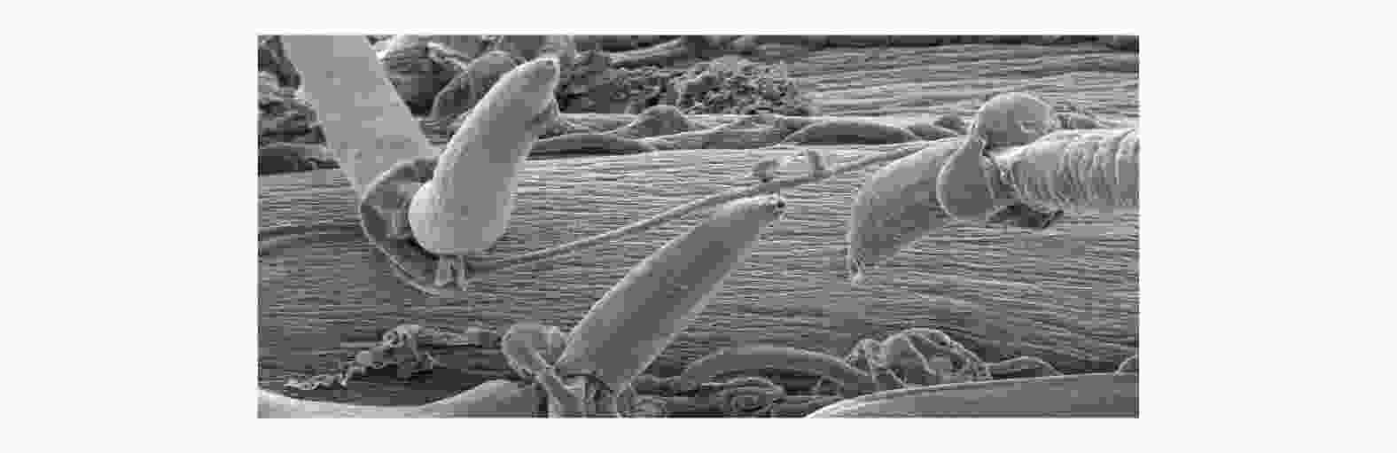 Nematode trapped by fungus