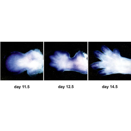 Gradient Wnt5a expression in the developing limb.