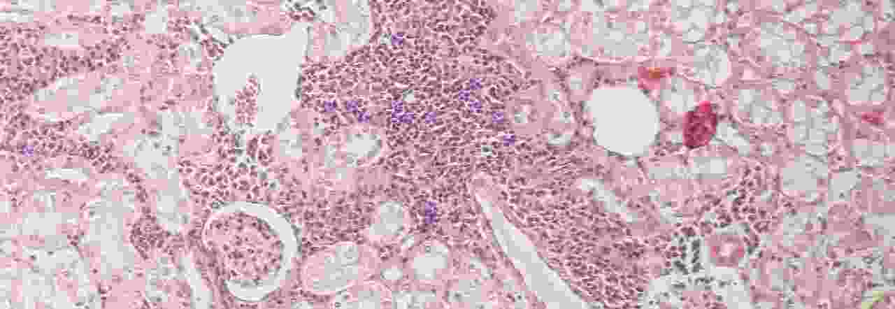autoimmunity.jpg