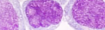 Cancer drug discovery_tile.jpg