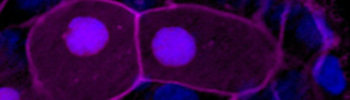 Cell life and death_tile.jpg