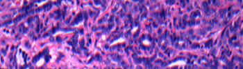 Modeling cancer_tile.jpg