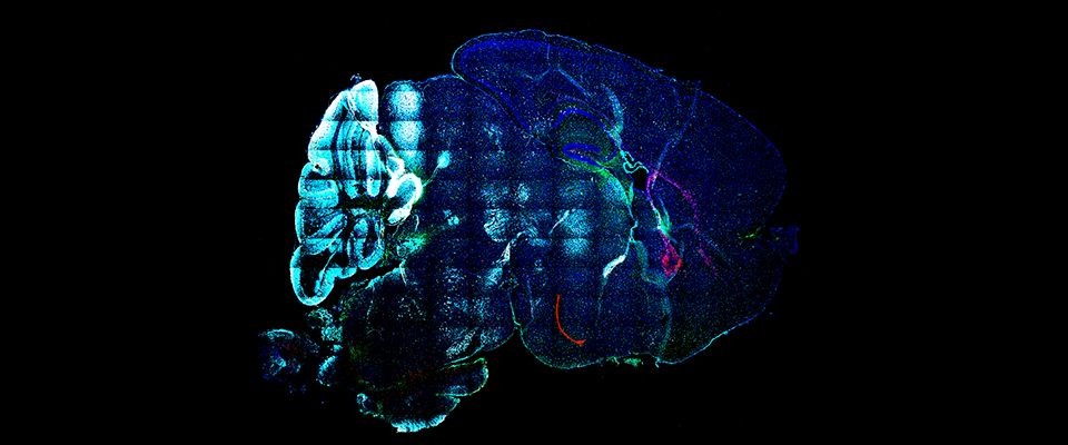 mouse brain