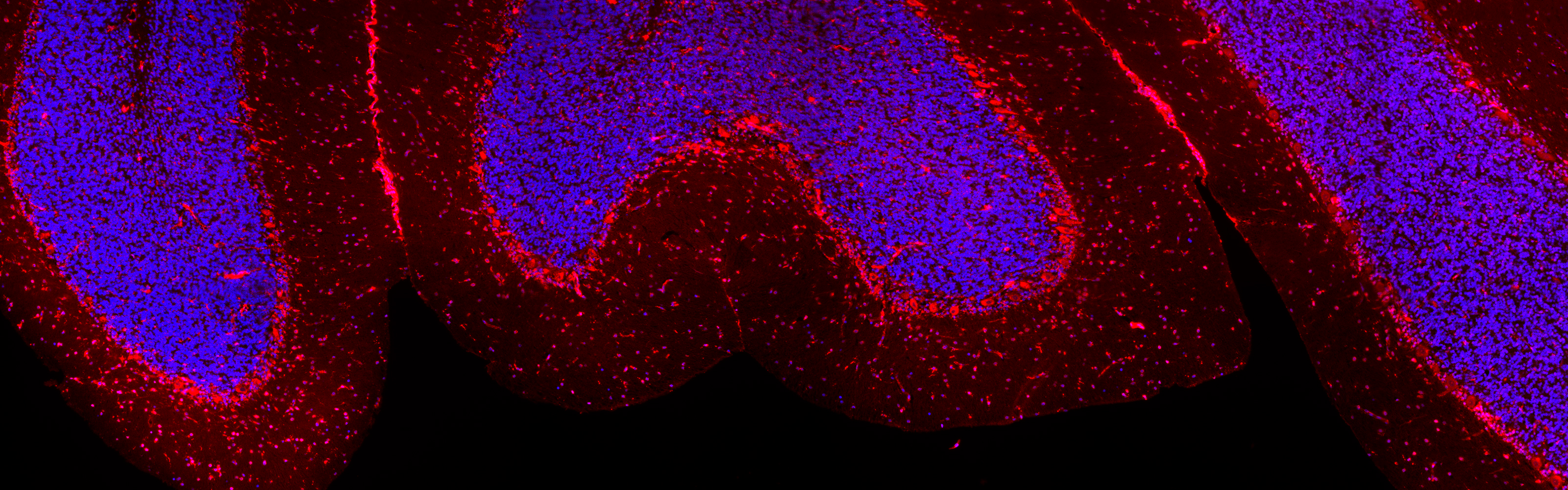 Chantal, Julia, Coverart tiles.lif - 5ezoom1_Merging_001 (RGB).jpg