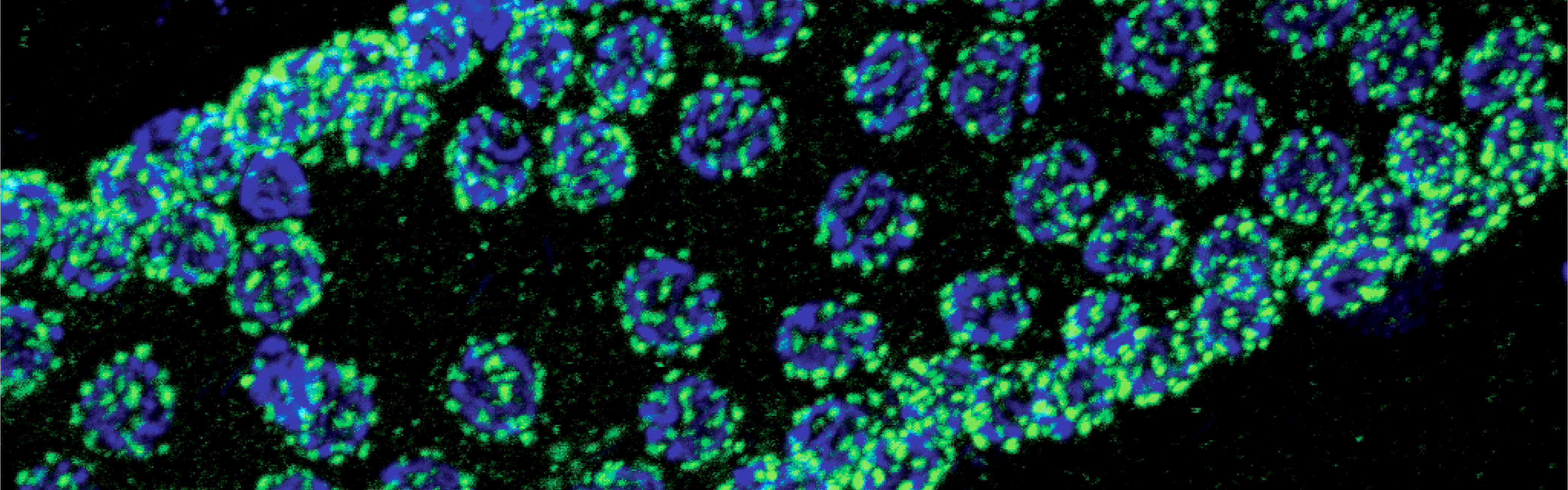 CM Celegans,N2_1_AMB.jpg